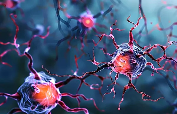 Demyelinating Disorders