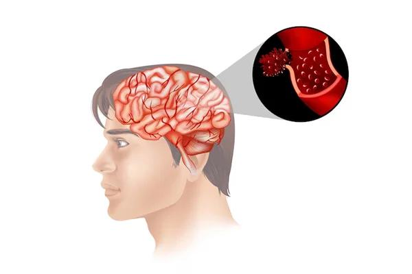 Brain Tumors and Lesions
